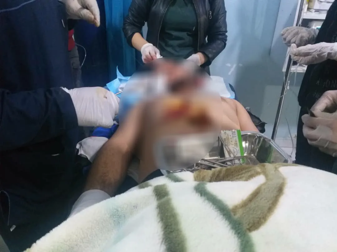 Sarin explosion left 8 wounded, significant material damage