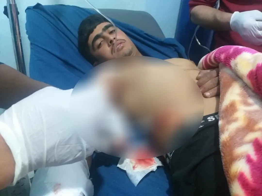 Sarin explosion left 8 wounded, significant material damage