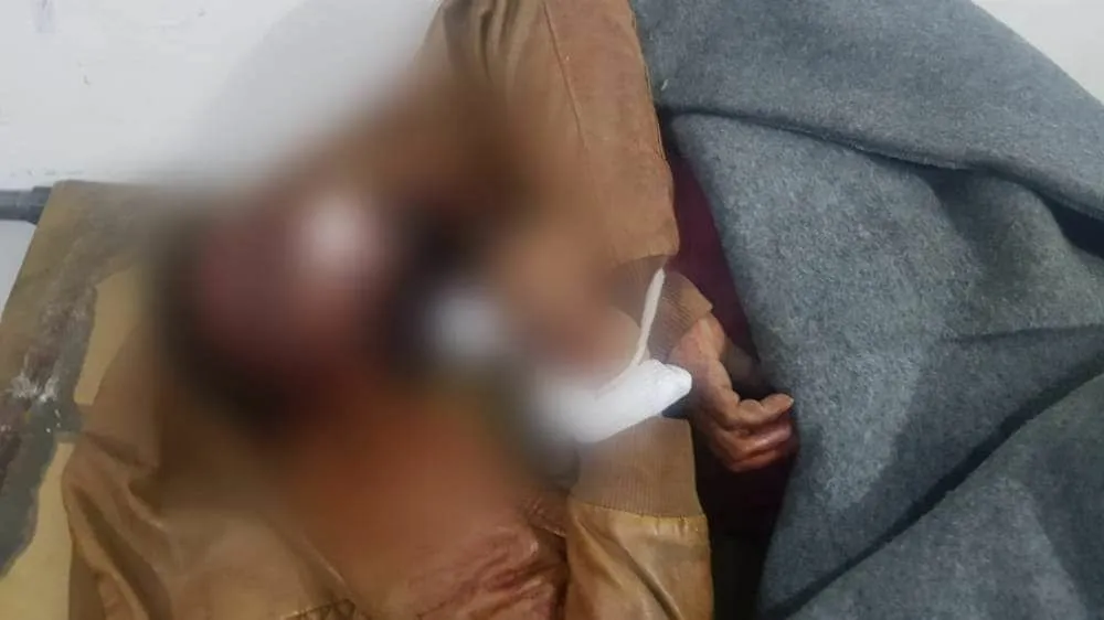  Two gunmen assassinate young in Deir Ezzor, but were run over