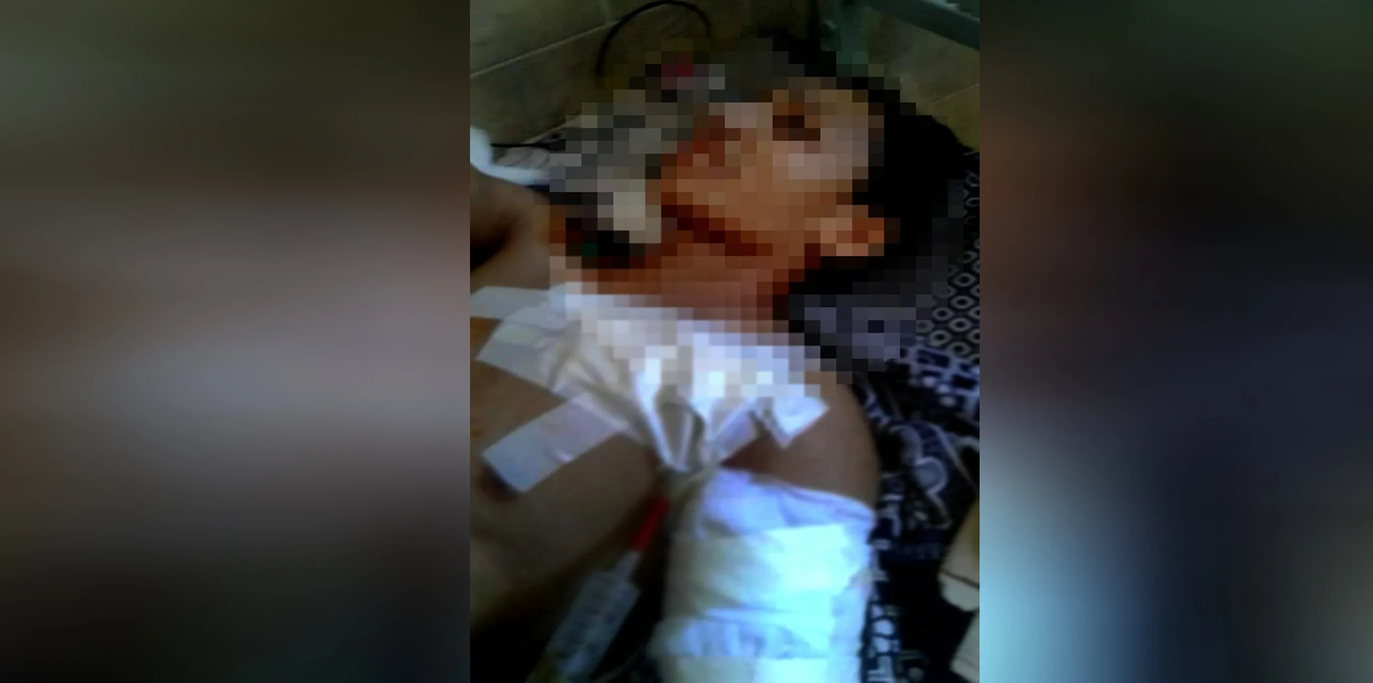 Young man wounded in Deir Ezzor eastern countryside being targeted by unknown persons