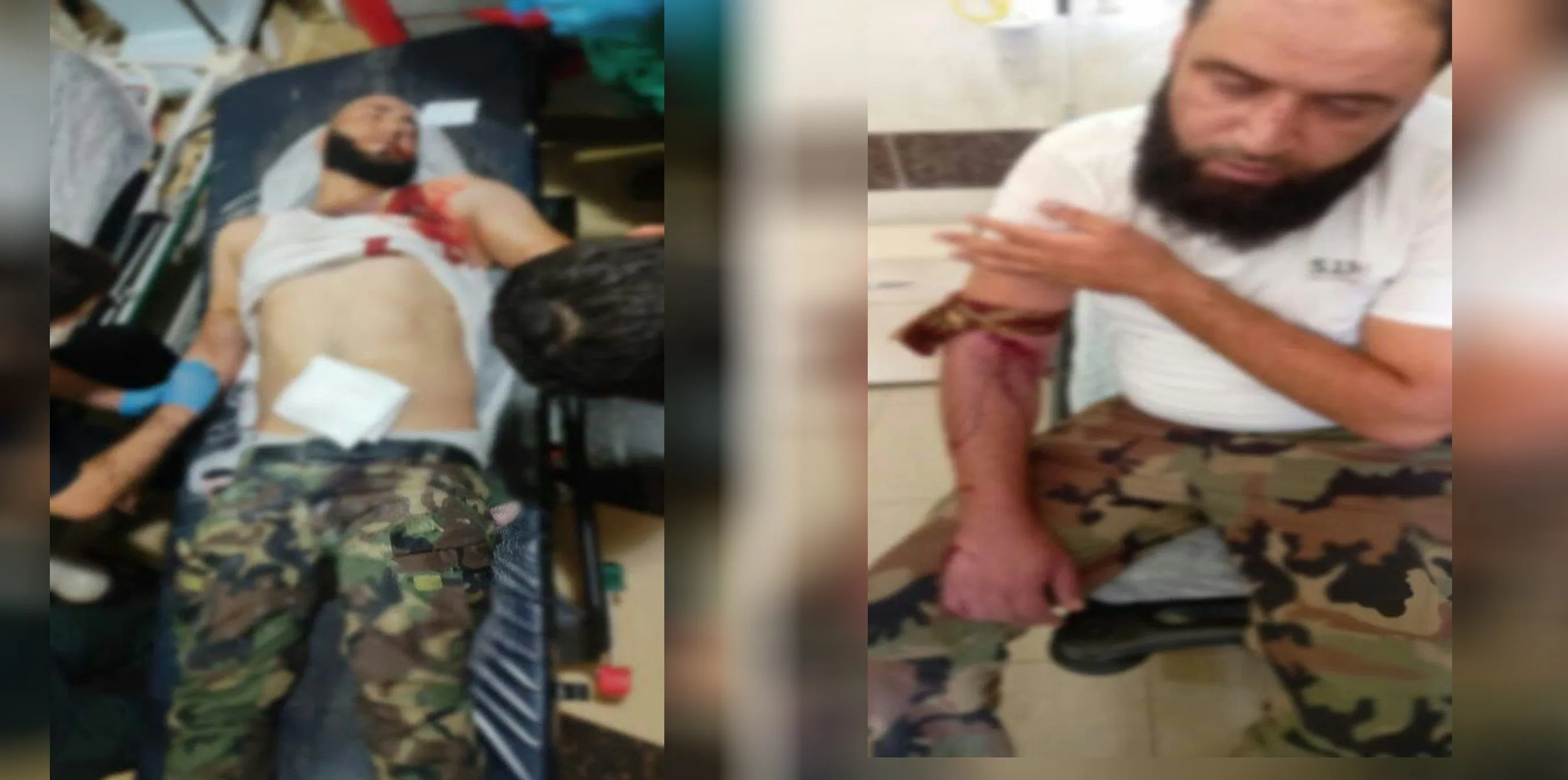 Dead, wounded at mercenaries' ranks on background of sharing stolen things 