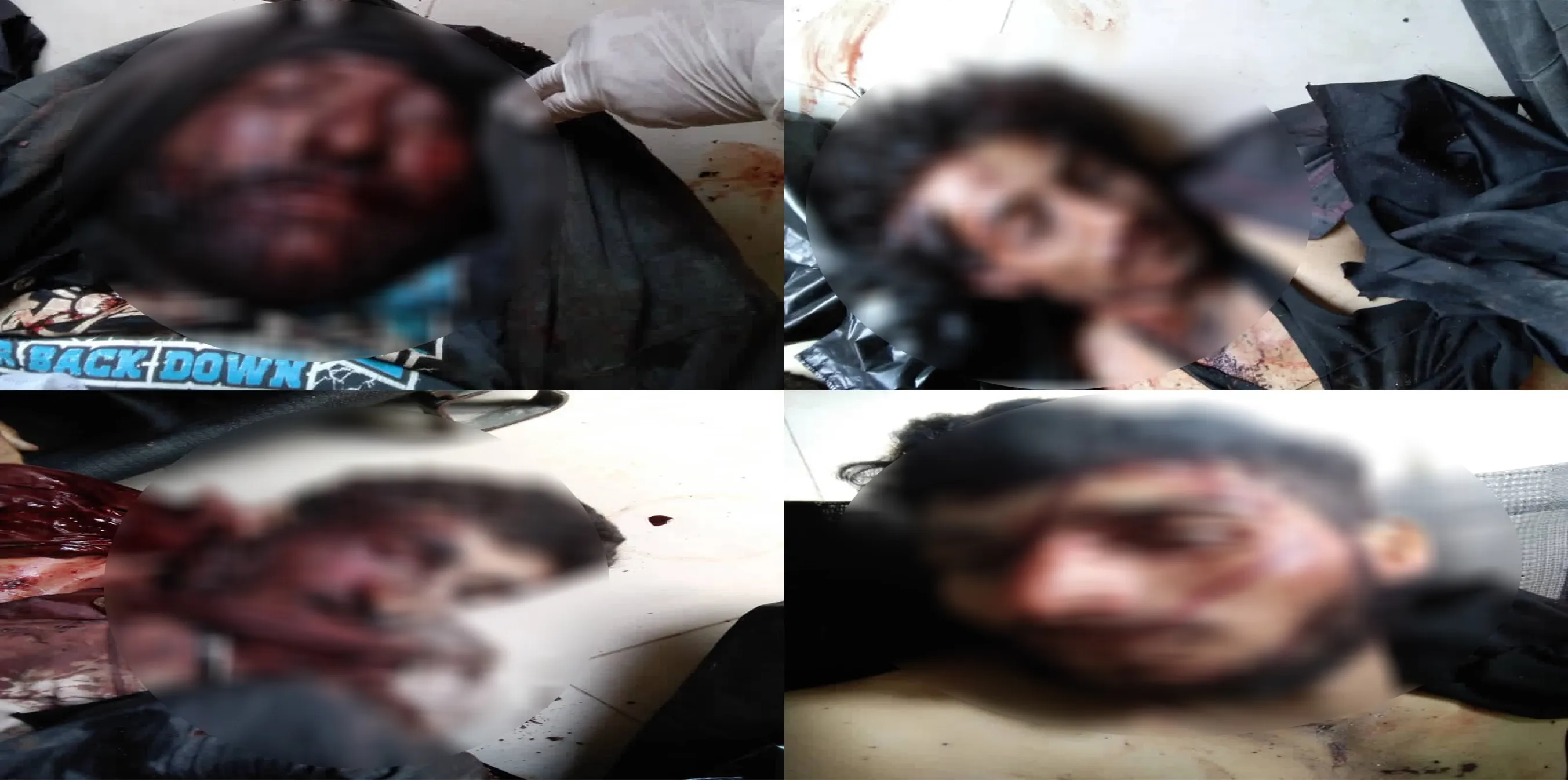 ​​​​​​​Dibis casualties rises to 4 as shelling proceeds