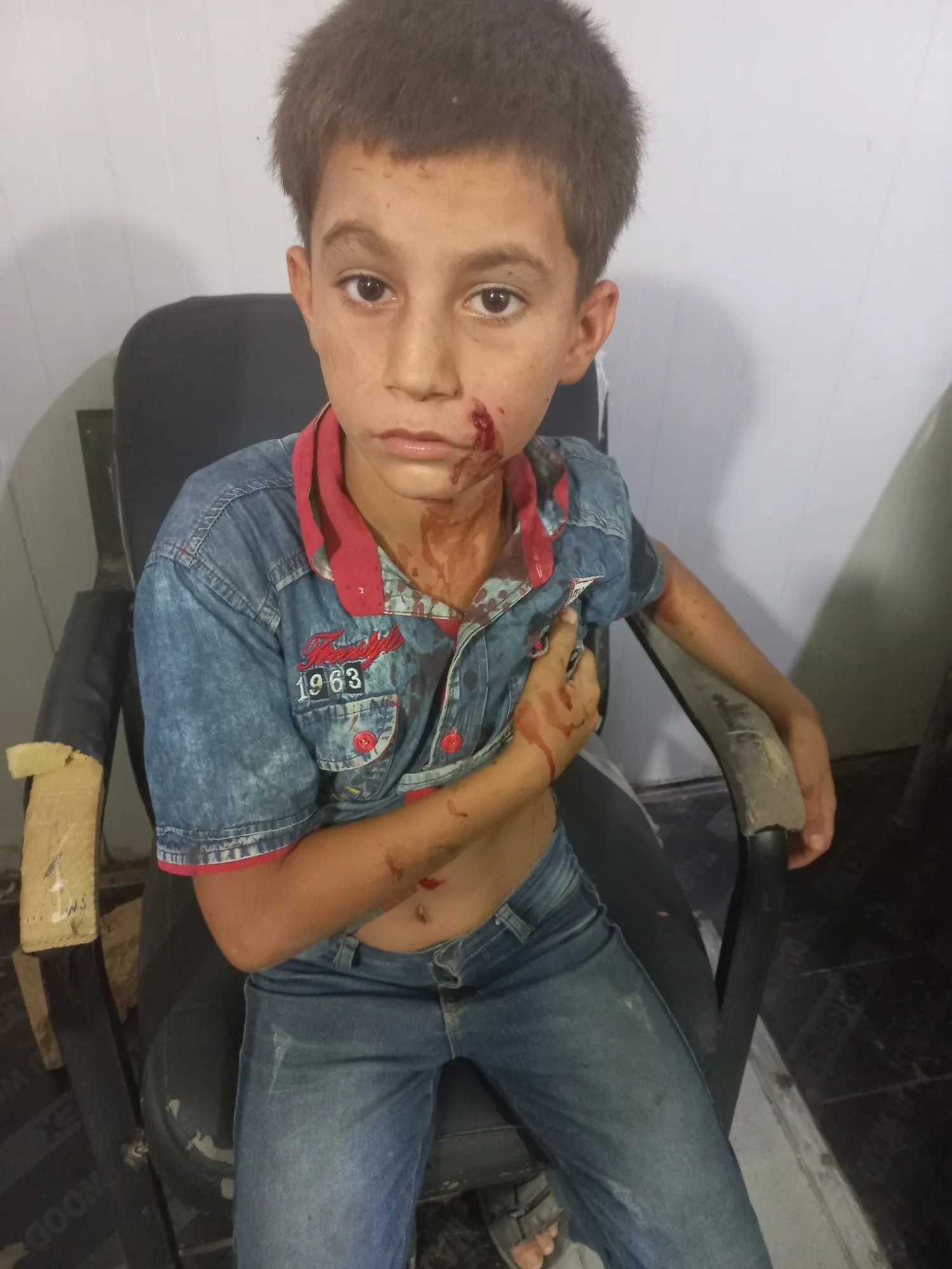 4 children injured in a mine explosion left by mercenaries in Al-Shahba