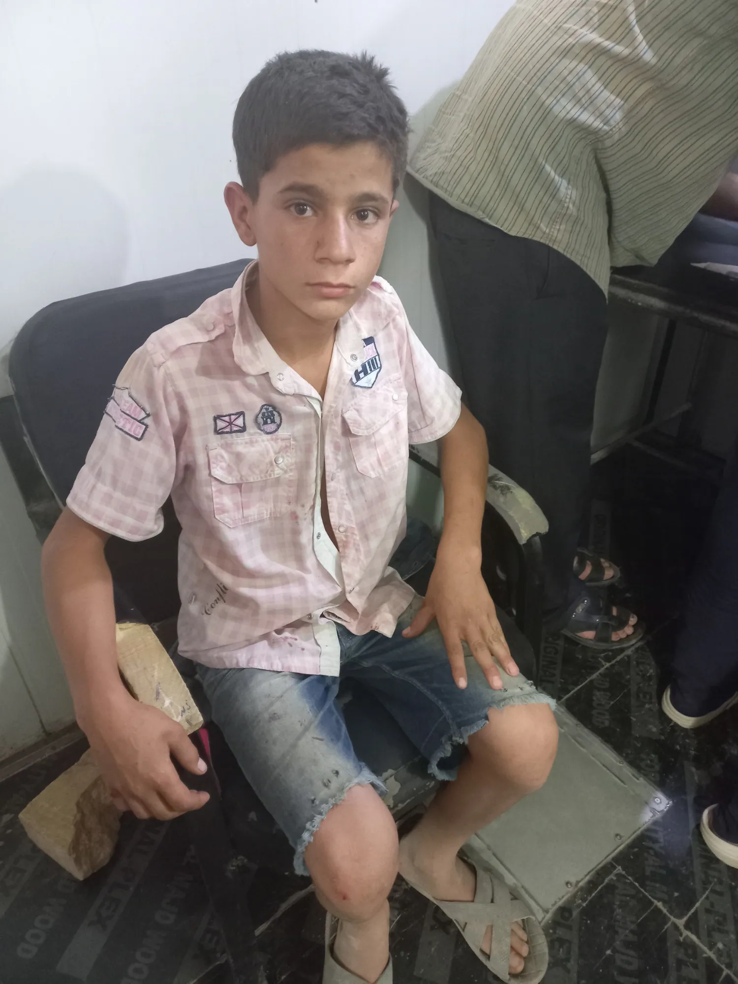 4 children injured in a mine explosion left by mercenaries in Al-Shahba