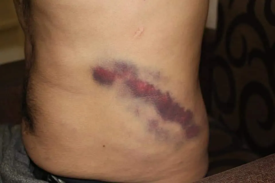 Turkish Gendarmerie threw 3 young from cement wall in Northern Kurdistan