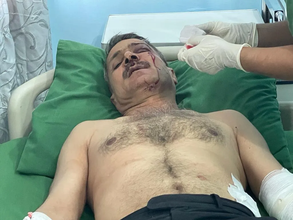 3 civilians injured in a Turkish drone attack in Kobani