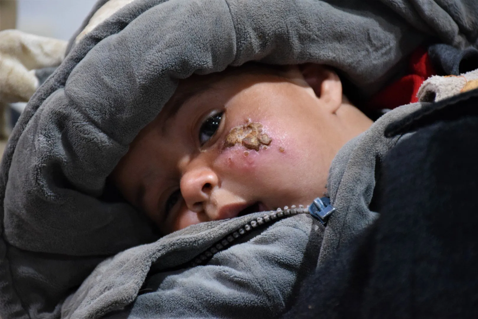 The occupied areas turn into a focus for the spread of Leishmaniosis