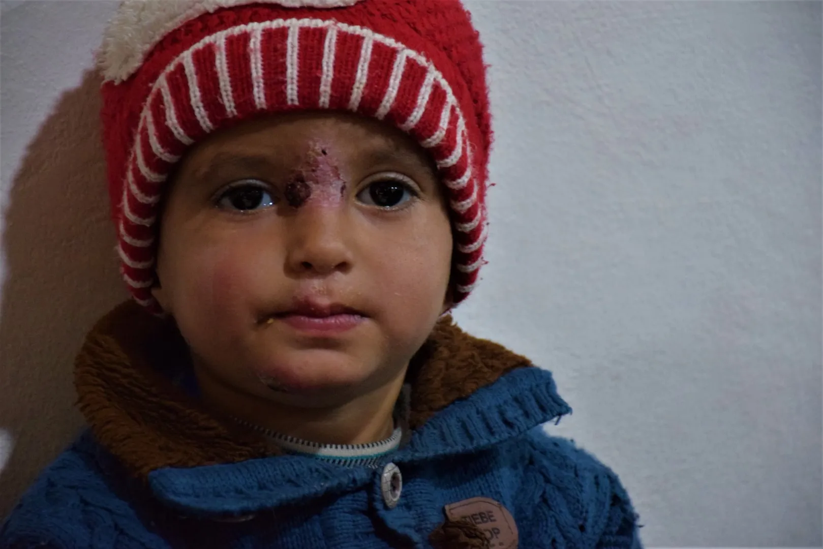 The occupied areas turn into a focus for the spread of Leishmaniosis