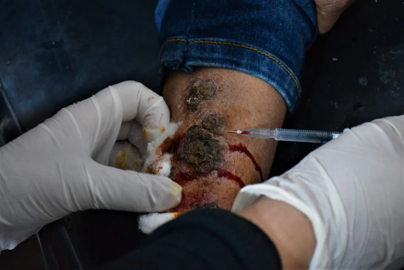 The occupied areas turn into a focus for the spread of Leishmaniosis