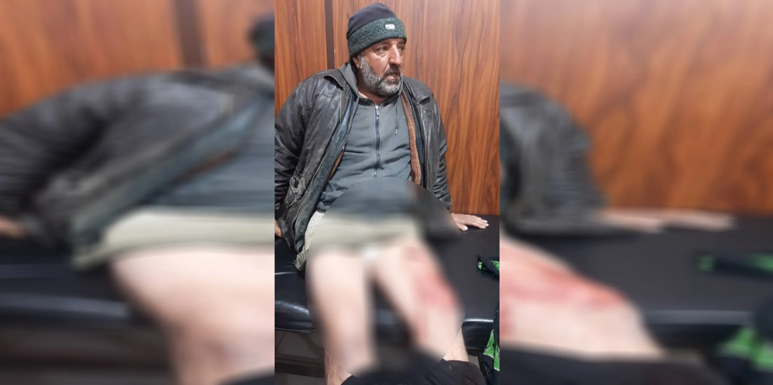 Civilian injured in Turkish shelling of Zarkan countryside