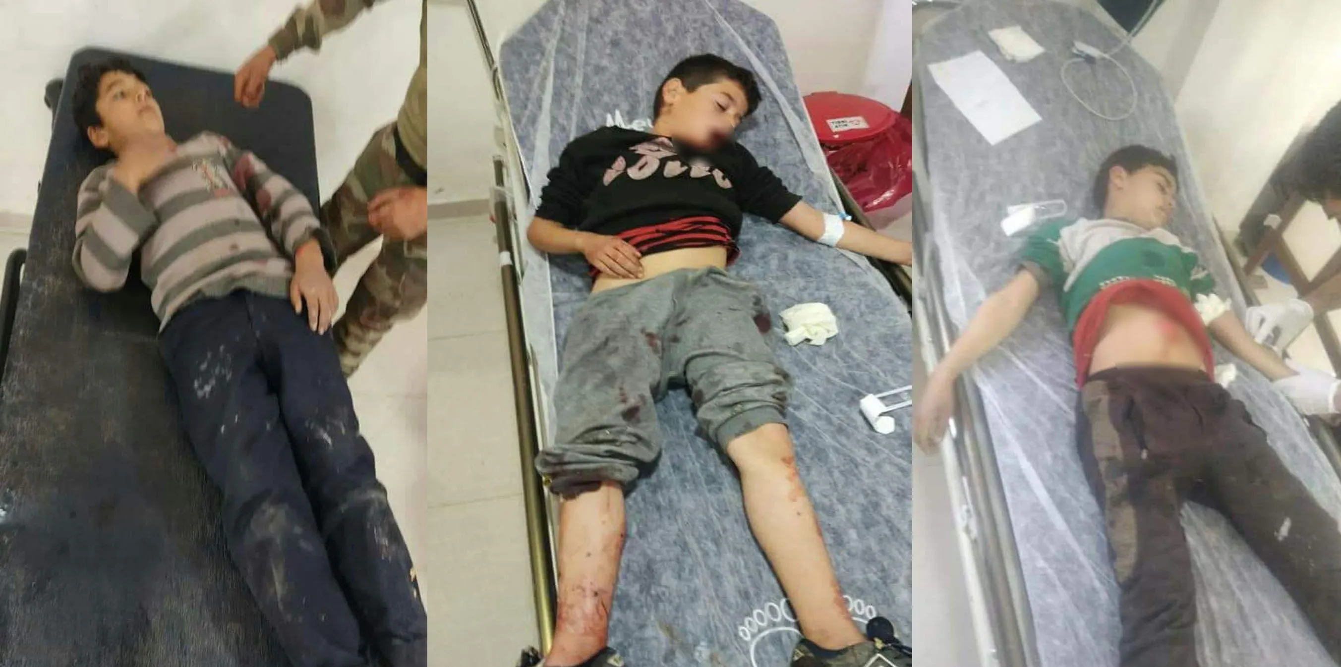 5 children injured in mercenary mine explosion