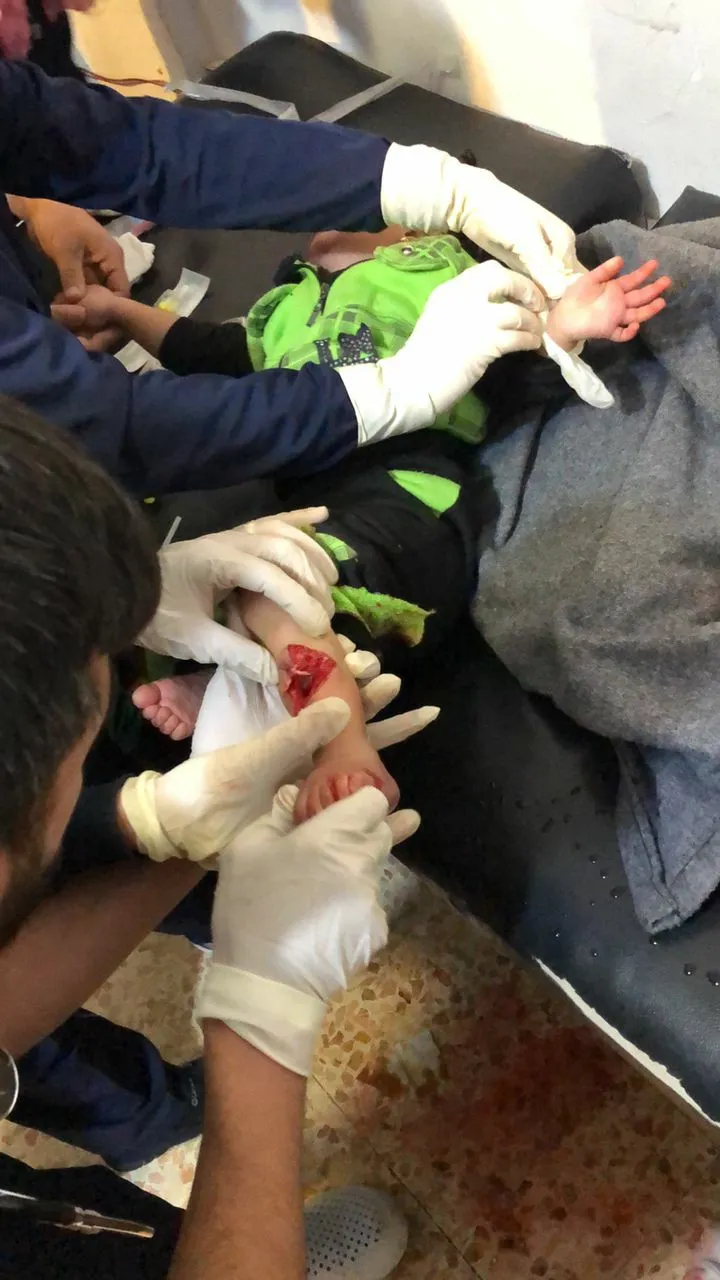 ​​​​​​​2 children and 2 women were injured in Turkish bombing on Ain Issa