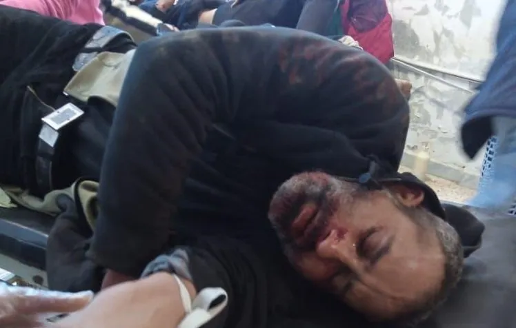 ​​​​​​​Citizens were injured in Turkish bombing of Mshairfa village in Ain Issa countryside