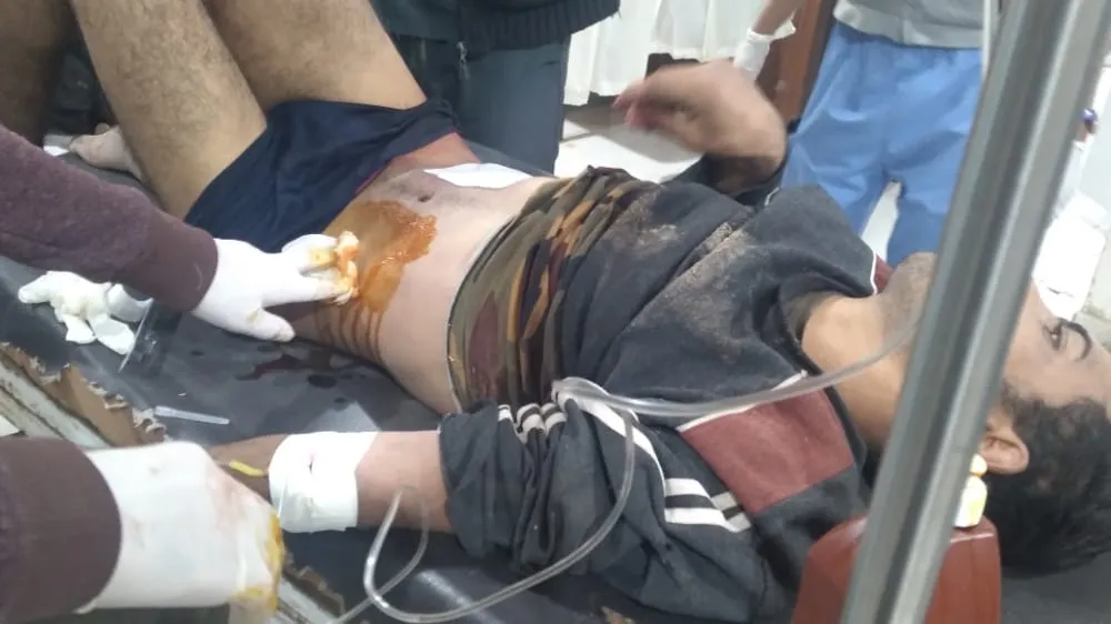 Damascus government forces’ soldier wounded due to Turkish shelling