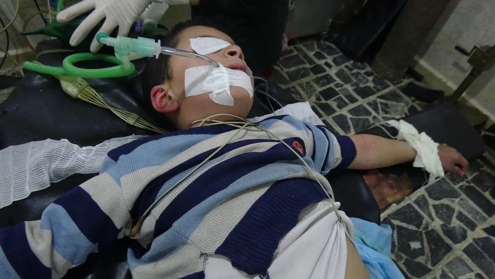 In pictures and videos... aftermath of Turkish occupation bombing on Tel Rifaat district