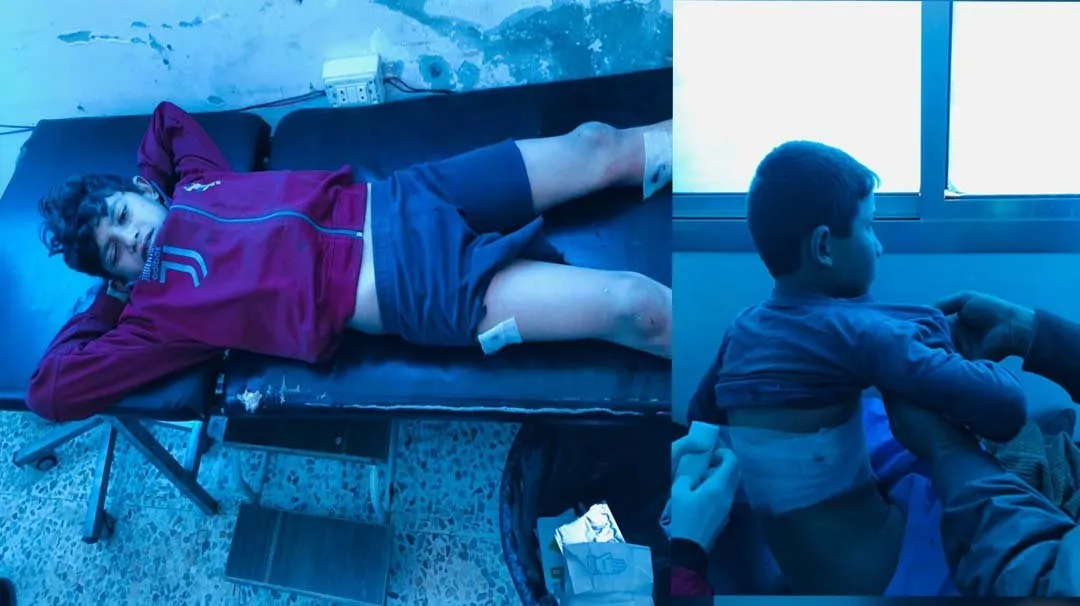 2 children injured east of Ain Issa, Turkish bombing continues on its west