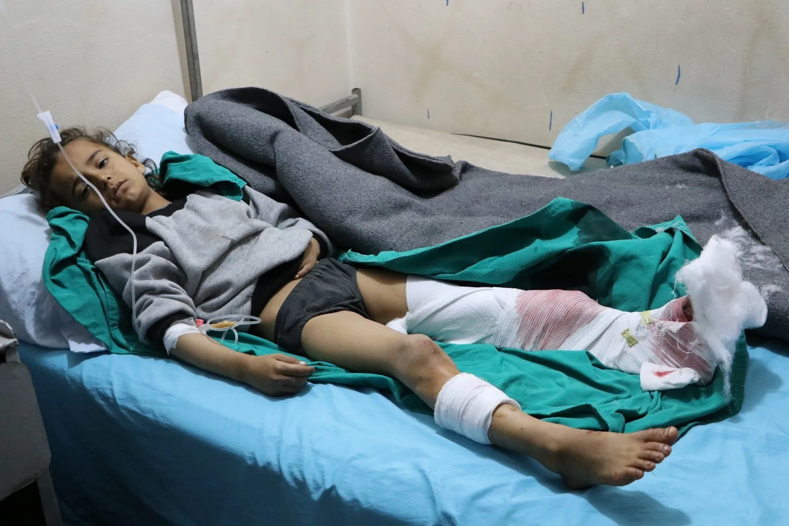 A father and his 2 children injured after ISIS remnant mine exploded in Shahba canton