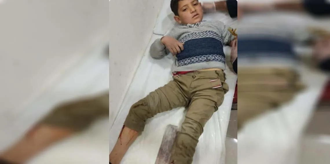 10 children injured by mercenaries in Afrin