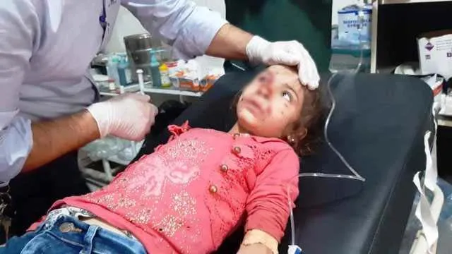 ​​​​​​​Turkish forces crimes against children in Ain Issa-Gire Spi