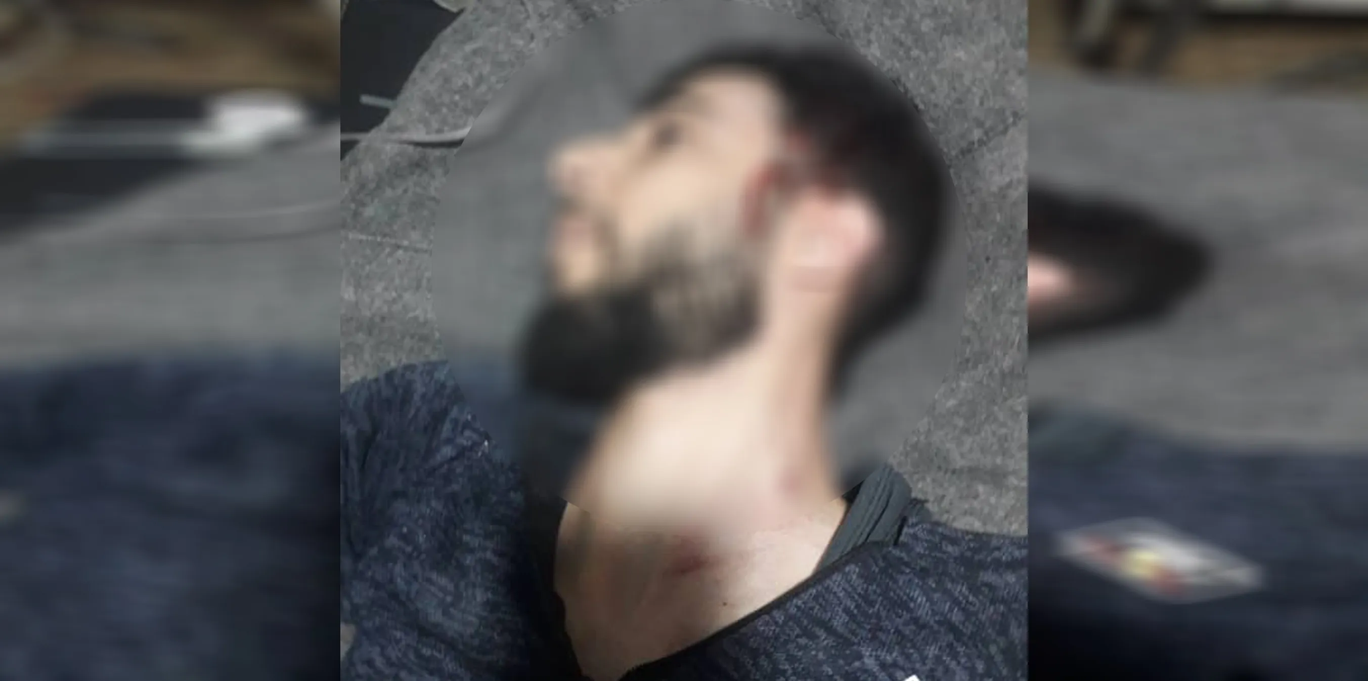 Iraqi youth injured in an armed attack in al-Hol Camp