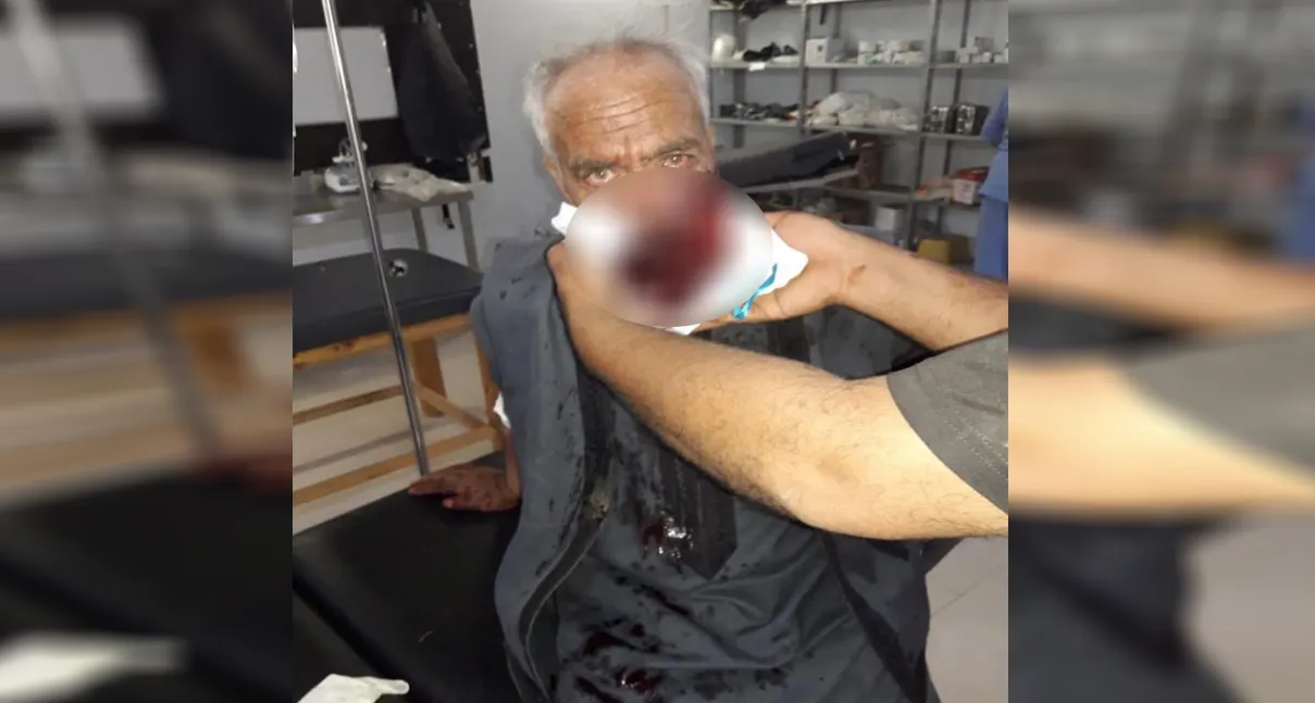 ​​​​​​​Citizen loses his life in Turkish occupation shelling on Khani
