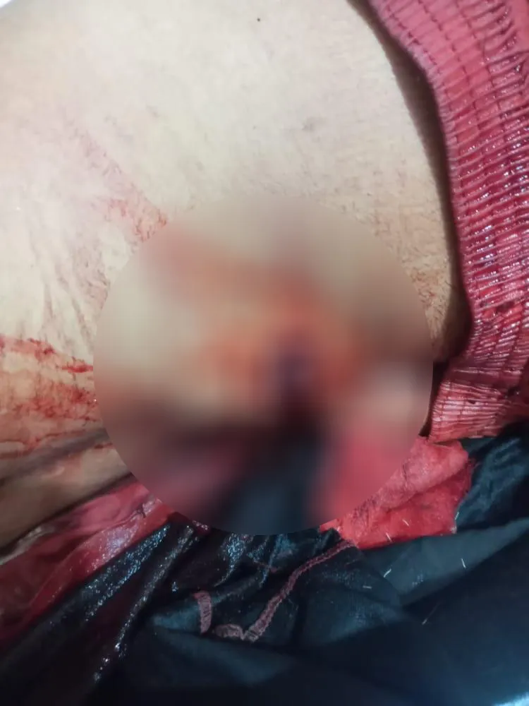 ​​​​​​​ANHA documents the names of the wounded as result of Turkish attack on Qartage farm