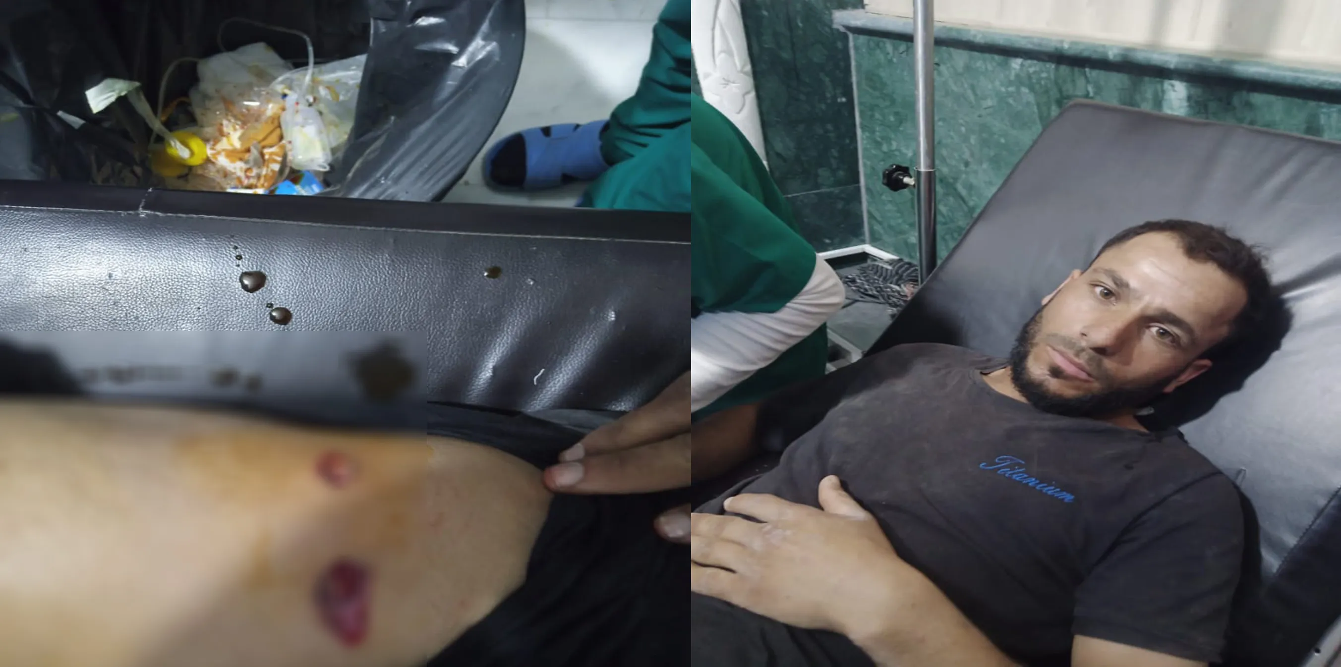 ​​​​​​​Civilian was wounded in Turkish bombing west of Ain Issa