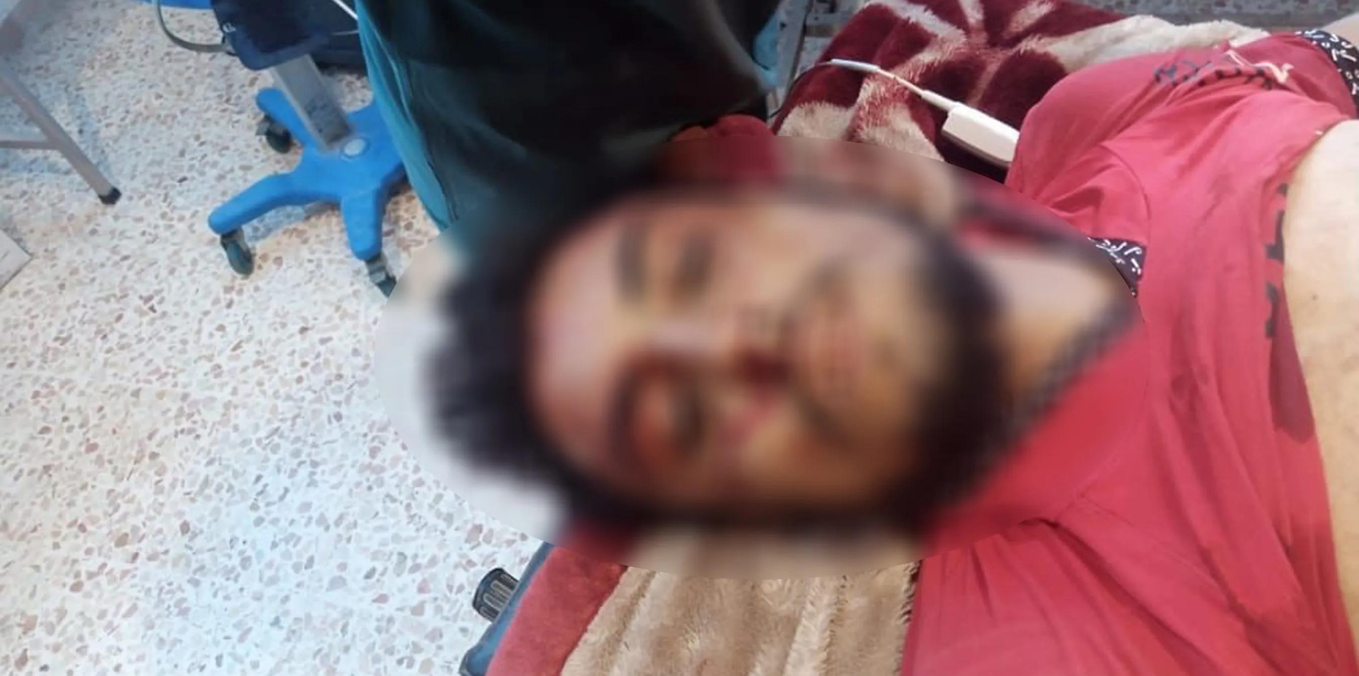 Turkish suicide drone targets a citizen east of Ain Issa district