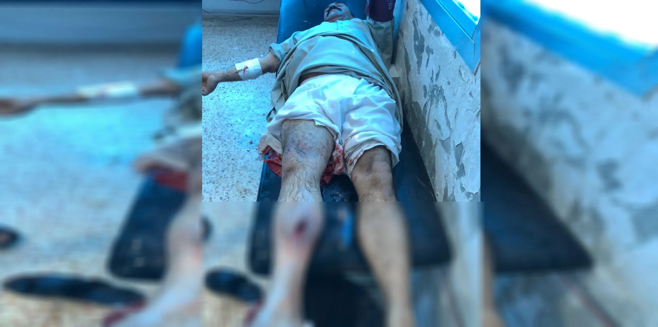Citizen injured by Turkish occupation sniper in Ain Issa