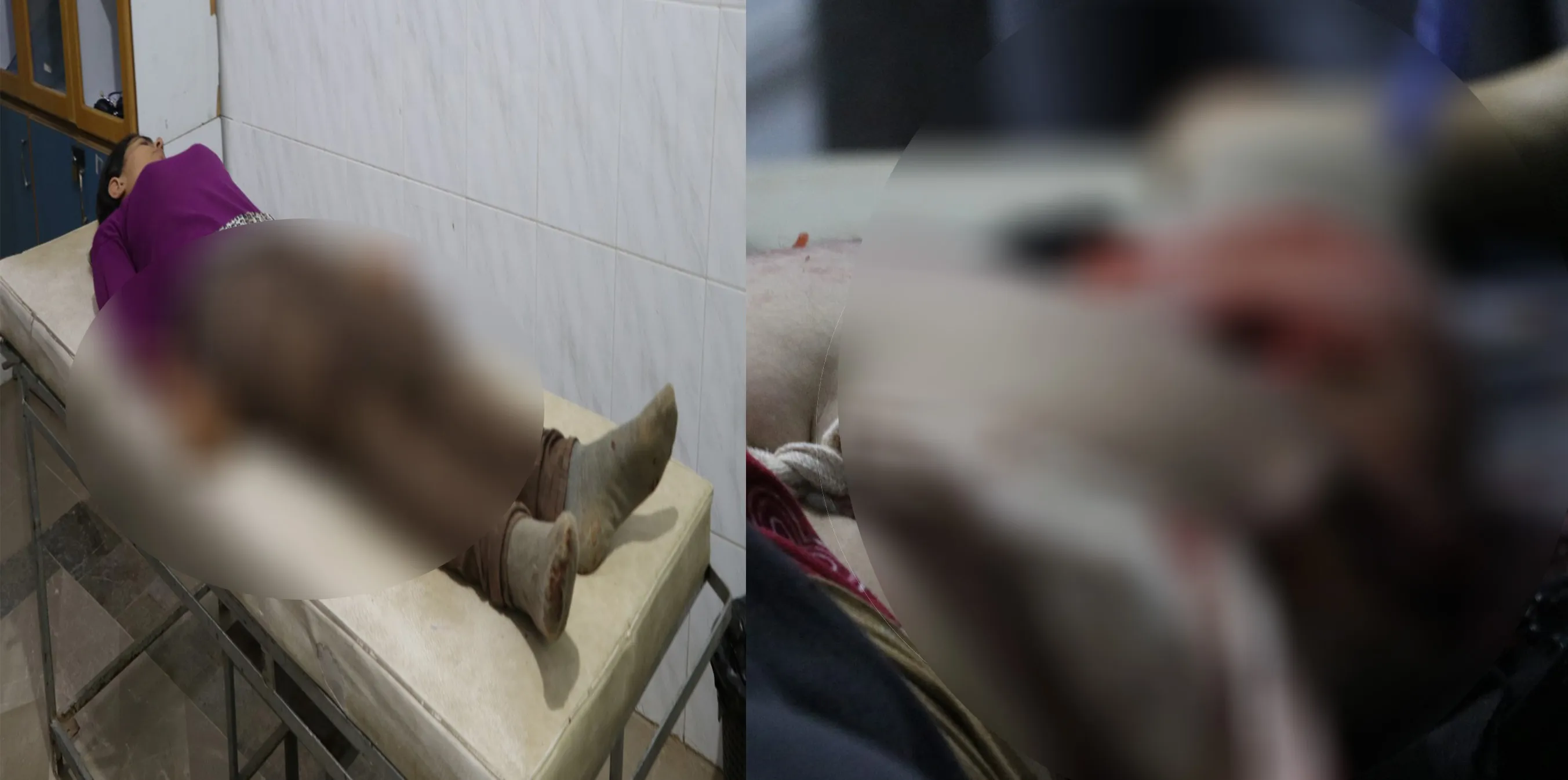 Azad Rasho: Women wounded are stable situation; critical conditions are treated in Aleppo hospitals