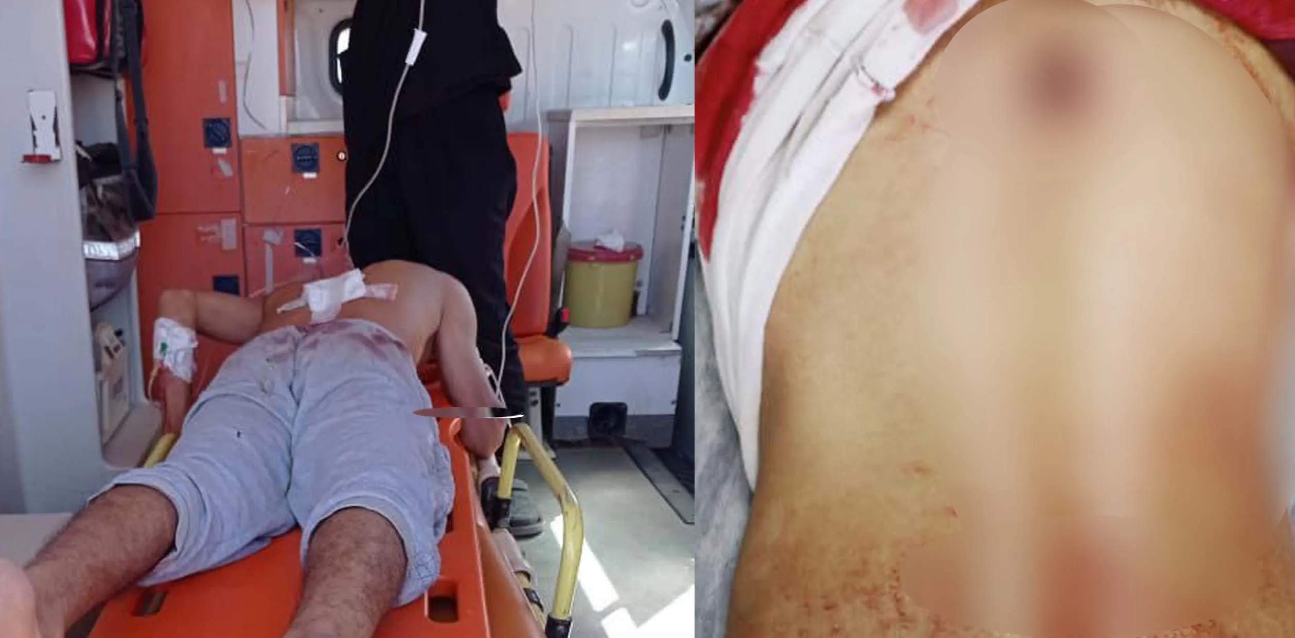 ​​​​​​​2 children wounded due to clashes between Turkish occupation gangs in Serêkaniyê