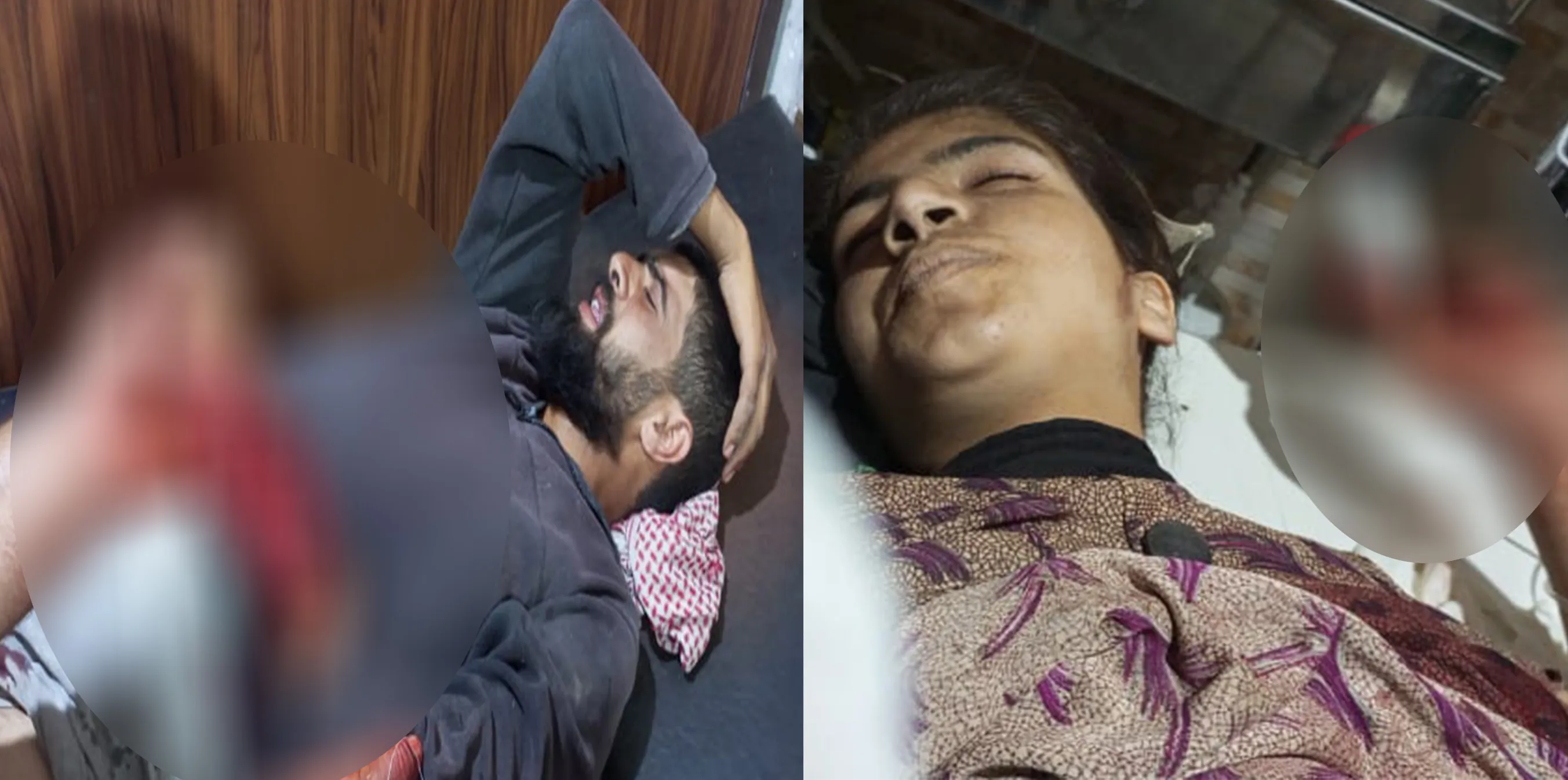 ​​​​​​​Young man, girl injured in shelling on countryside of Tal Tamr