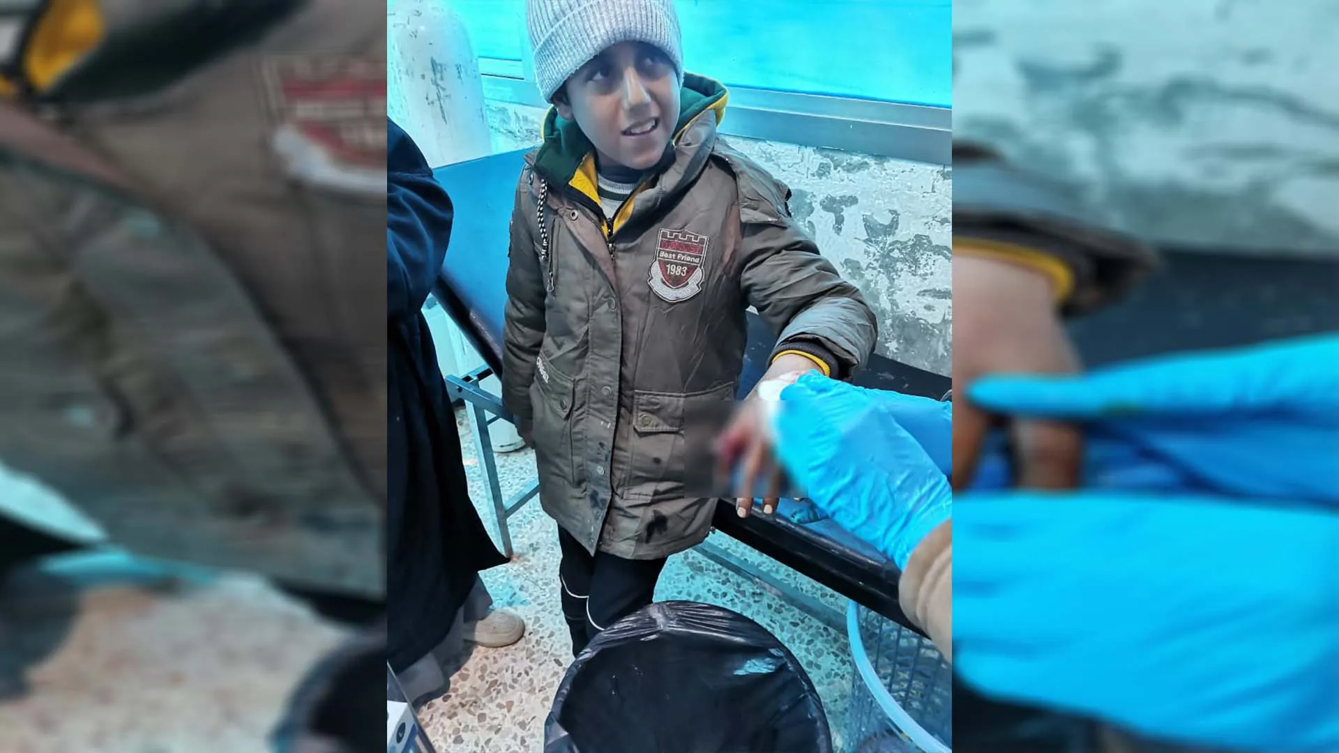 Child wounded in Turkish drone attack on Ain Issa