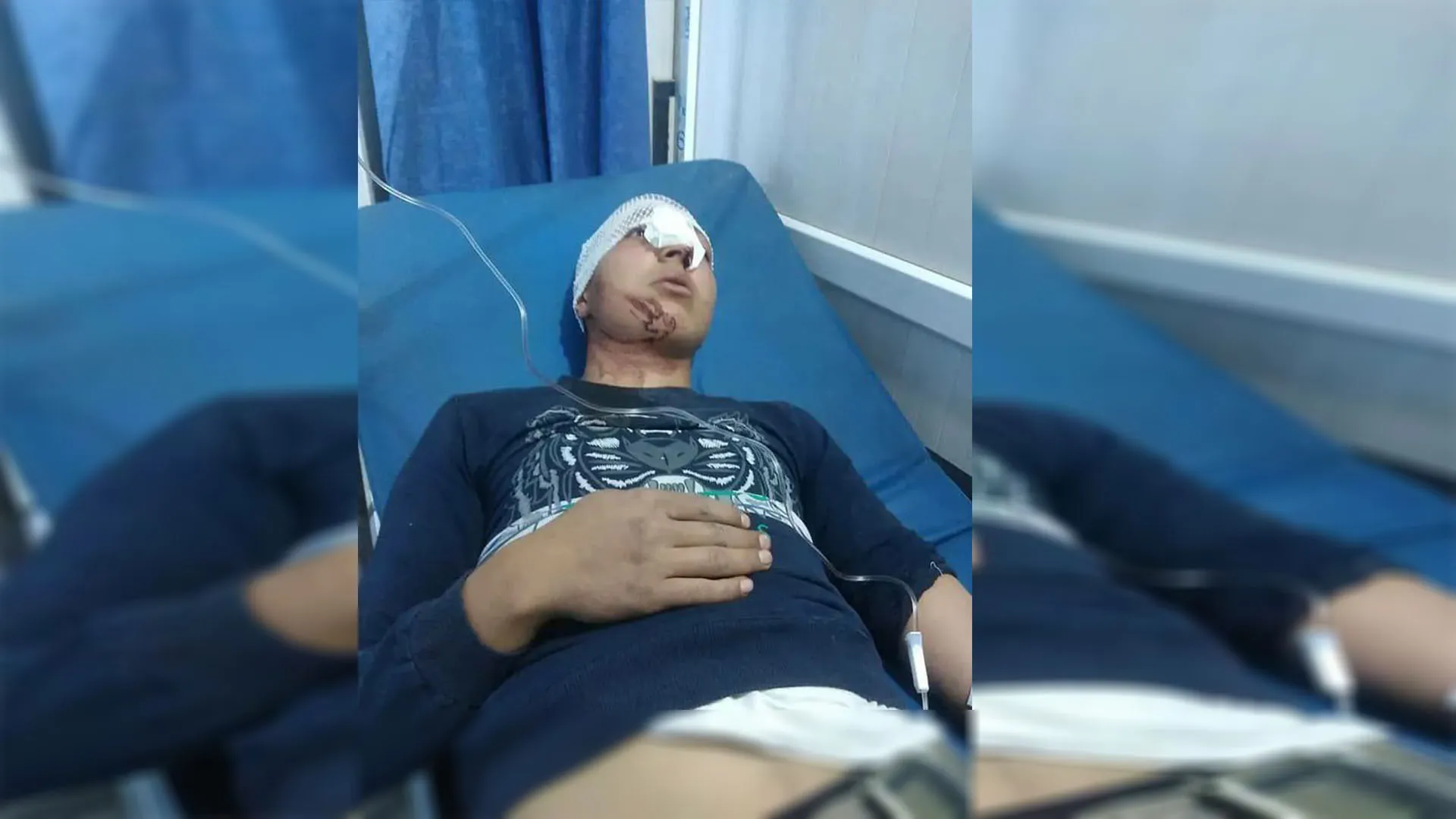Pro-Turkish gangs assault young man in Afrin, steal his motorcycle.