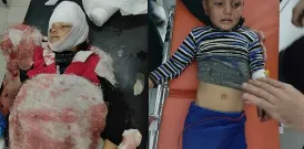 ​​​​​​​2 girls martyred, wounding 3 others from one family by Turkish occupation shelling