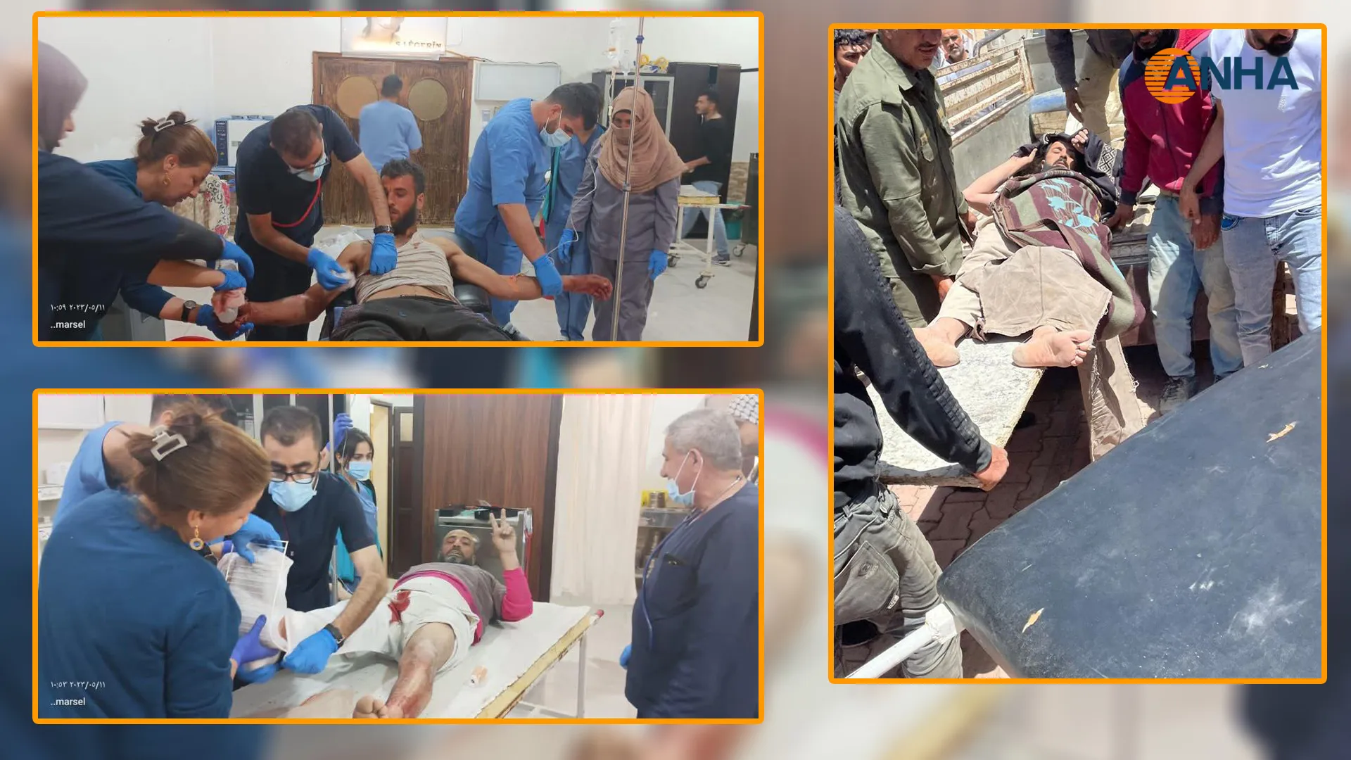Citizen martyred and 4 others were wounded in Turkish bombing