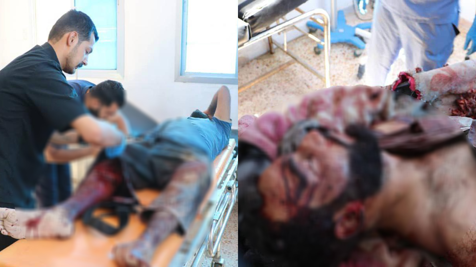 ​​​​​​​Citizen killed; others injured in occupation bombing on Ain Issa countryside