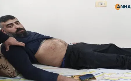 Electricity station worker injured as result of Turkish bombing