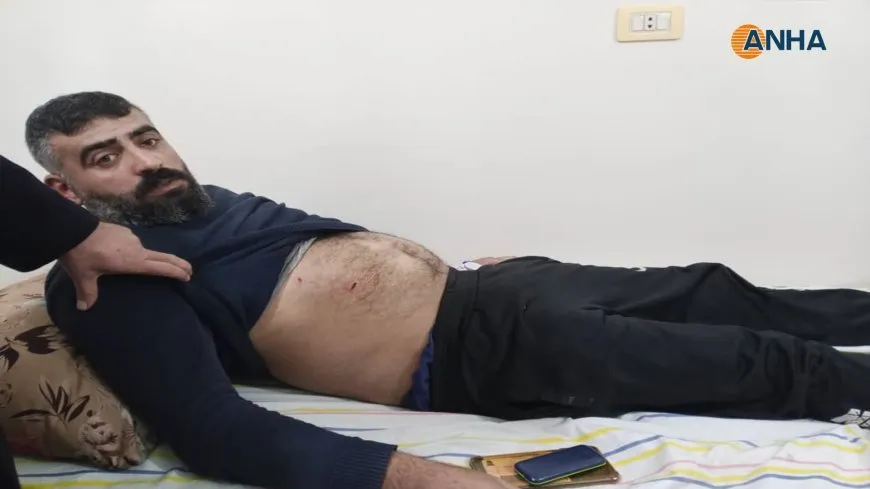 Electricity station worker injured as result of Turkish bombing