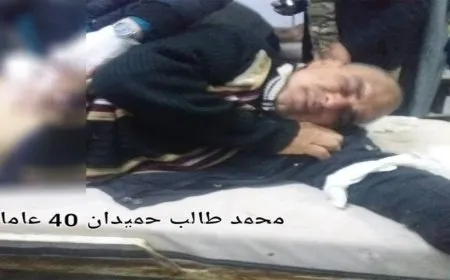 Child, his father wounded in Turkish bombing on Shahba