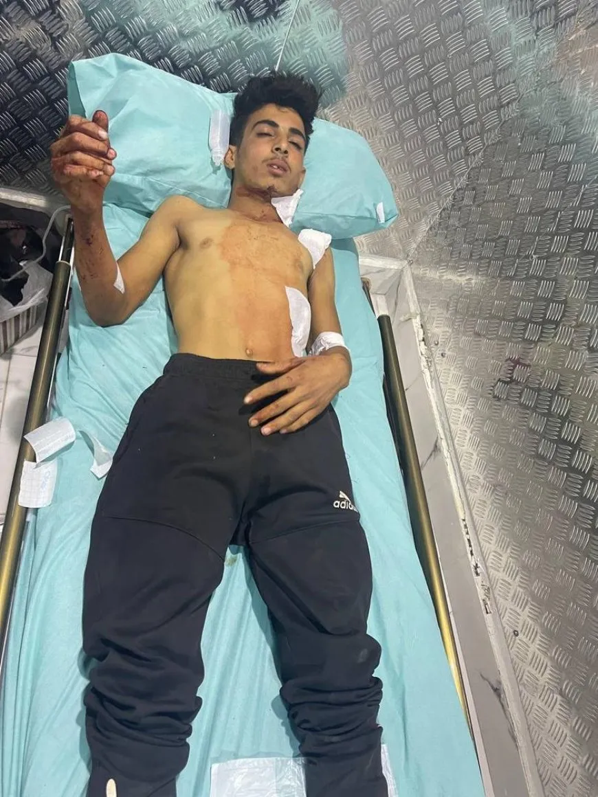 Names of 9 of those injured in Turkish bombing of Tal Hamis countryside 