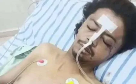 Citizen martyred from injuries sustained in Damascus forces shelling on Deir ez-Zor