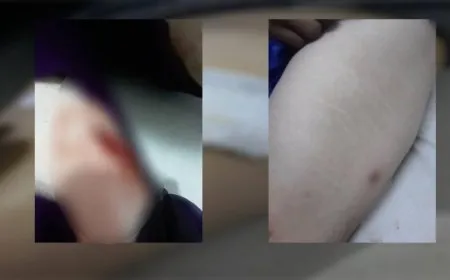 2 women, girl Injured in Turkish occupation’s attack on Tal Rifaat
