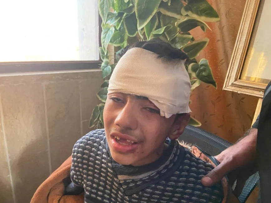 3 civilians martyred, 7 others wounded in Turkish shelling on Tishreen dam