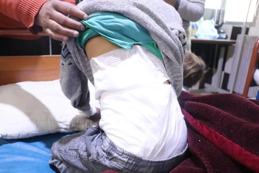 Injured in bombing of Ashma village: Turkish occupation state must be held accountable