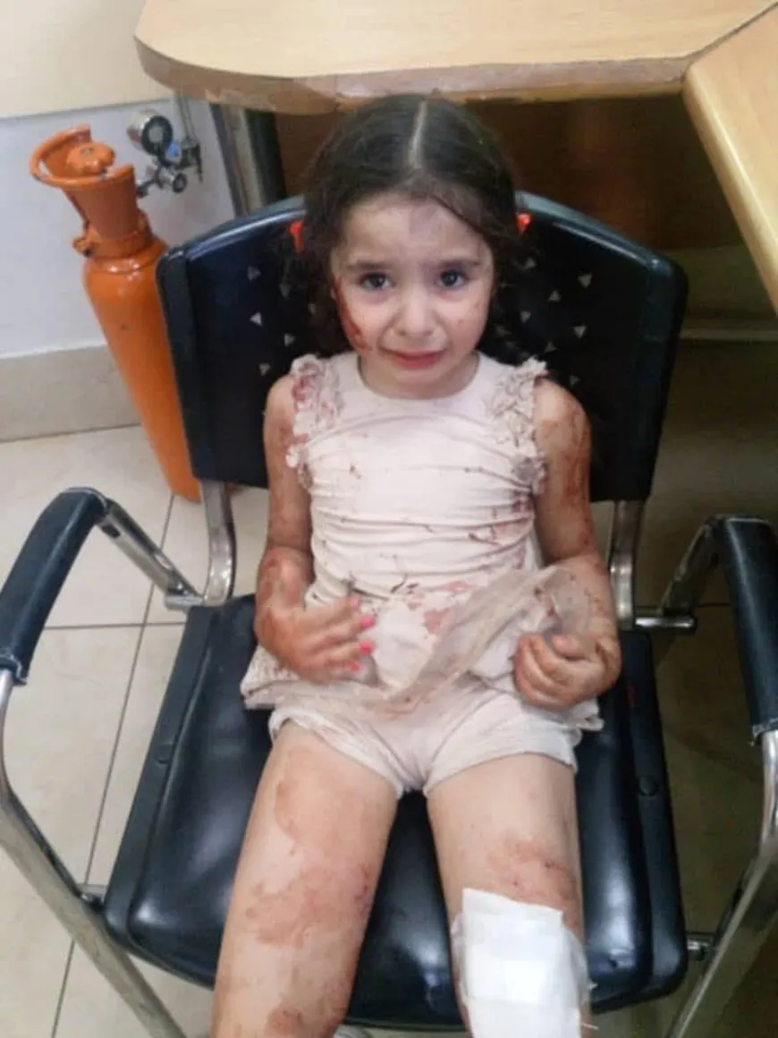 22 martyred, 63 injured by suicide bombing at Mar Elias Church in Damascus