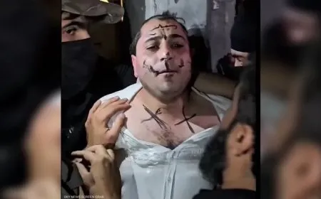 Artists face humiliation in transitional govt- held areas