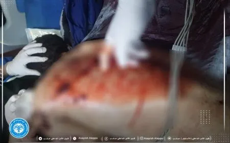 Civilian martyred in second attack on Sheikh Maqsoud