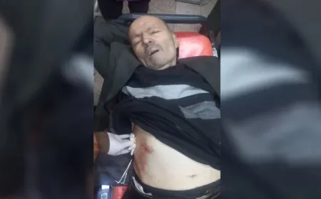 Another civilian injured in shelling by interim govt. mercenaries on Sheikh Maqsoud 