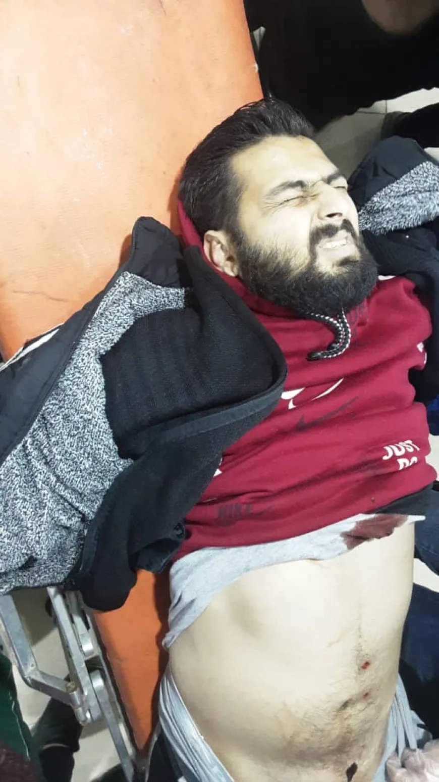 3 martyrs and 17 wounded inlatest toll from the interim government's shelling of Aleppo neighborhoods